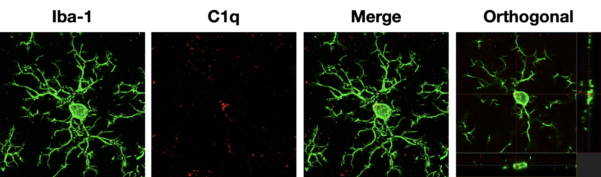 Microglia morphology research - Iba-1 and C1q immunofluorescence imaging